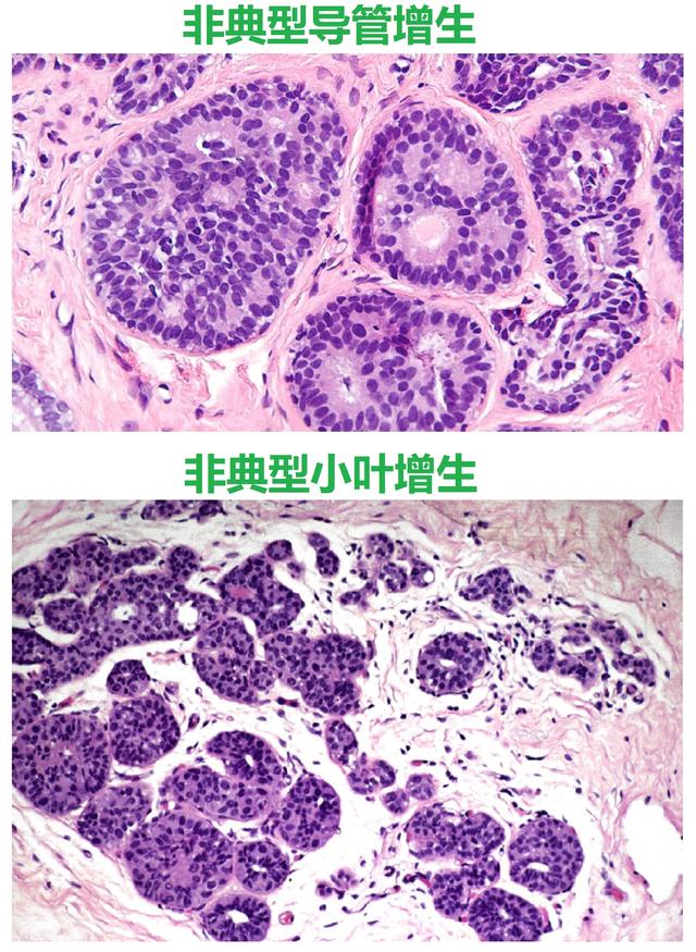 bsa牛血清白蛋白_牛血清白蛋白是不是bsa_biosharp牛血清白蛋白