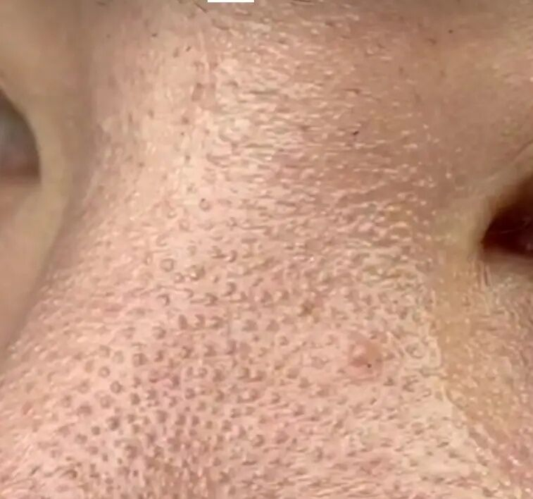 守门员开大脚进球视频_守门员开大脚技巧视频_守门员大脚开球
